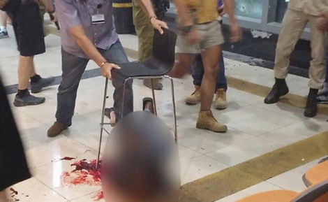 תוצאות נתיחת הגופה: האזרח האריתראי הפטום זרהום נהרג מהירי ולא מהלינץ'