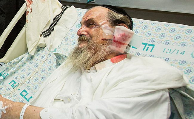 הרב פסח קרישבסקי