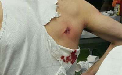 הבחור לאחר הירי