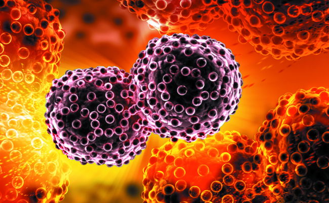 יש תקווה? טיפול חדשני לסרטן הערמונית לא גורם לתופעות לוואי