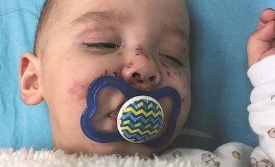 אימה בראשון לציון: תינוק ננשך בביתו על ידי חולדה