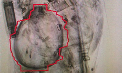 השיקוף בשדה דב גילה בתיק הנוסעת רימון הלם וקליעים