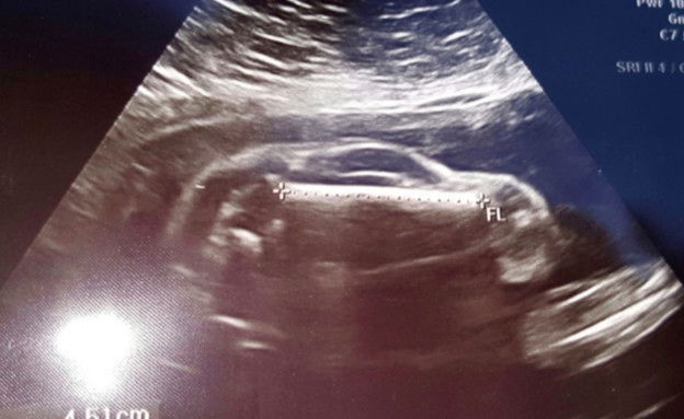 זה לא תינוק, זה רכב משפחתי