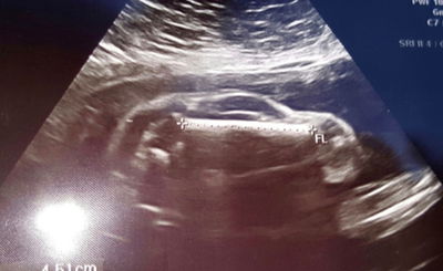 זה לא תינוק, זה רכב משפחתי