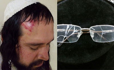 הרב פוקס ומשקפיו השבורים