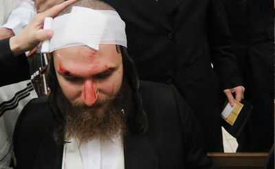 האברך שהוכה, לטענת חבריו - על ידי "בריונים שנשכרו מטעם חכמת לב"