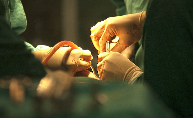 שלושה עצורים בחשד לניהול רשת לסחר באיברים