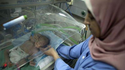 הטיפול נכשל: התאומות הסיאמיות שנולדו בעזה מתו
