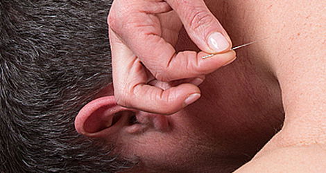 מרן הגראי"ל שטיינמן התנגד ל'דיקור סיני': "דוקר בארנק..."