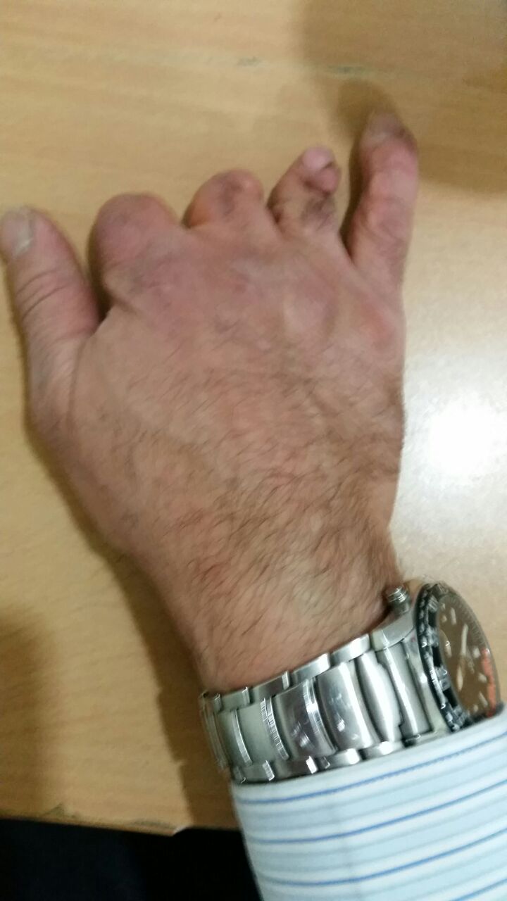 הנזק בידו של יהושע