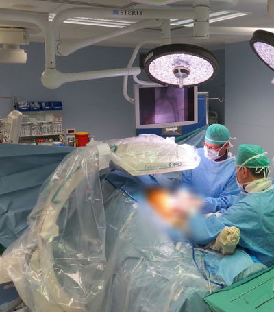 הארכת גפיין במרכז הרפואי שערי צדק