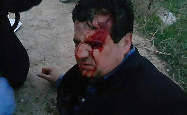 ח"כ עודה פצוע