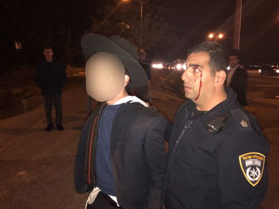 שוטר שנפצע מאבן בעינו באחת ההפגנות