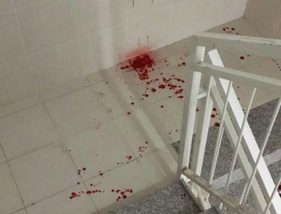 זירת האירוע