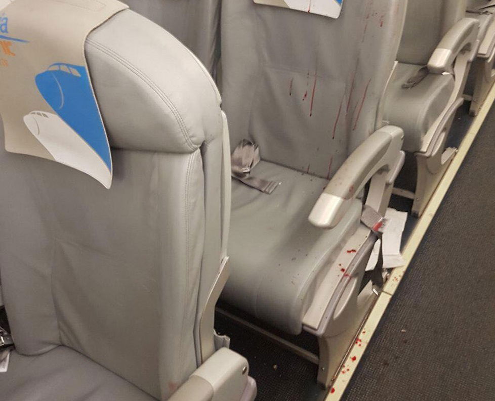 נוסעים התקוטטו בטיסת ארקיע עד זוב דם