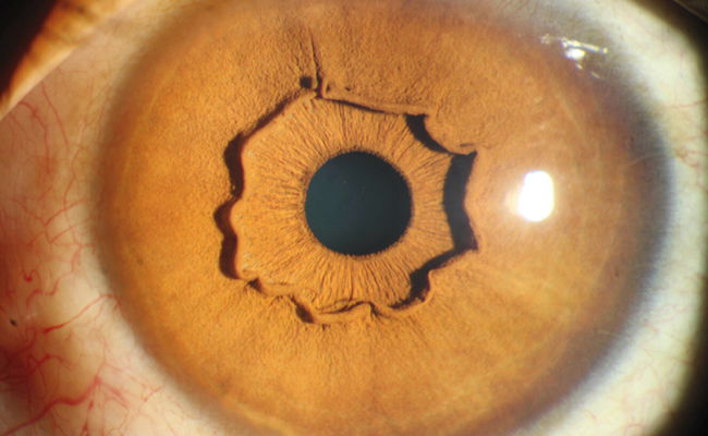 הגירוד בעין הוביל לתגלית המפתיעה הזו