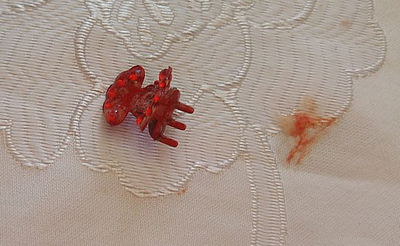 הסיכה שהפעוטה בלעה