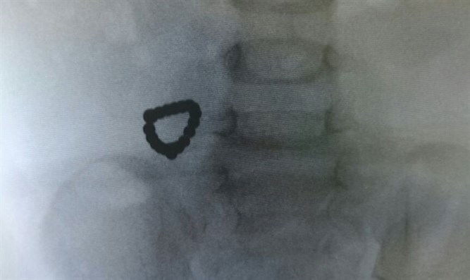 המגנטים, בתוך בטנו של התינוק