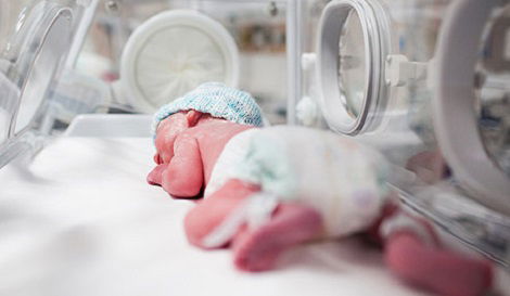 פגה. אילוסטרציה