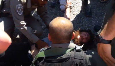 הצעיר שוכב פצוע