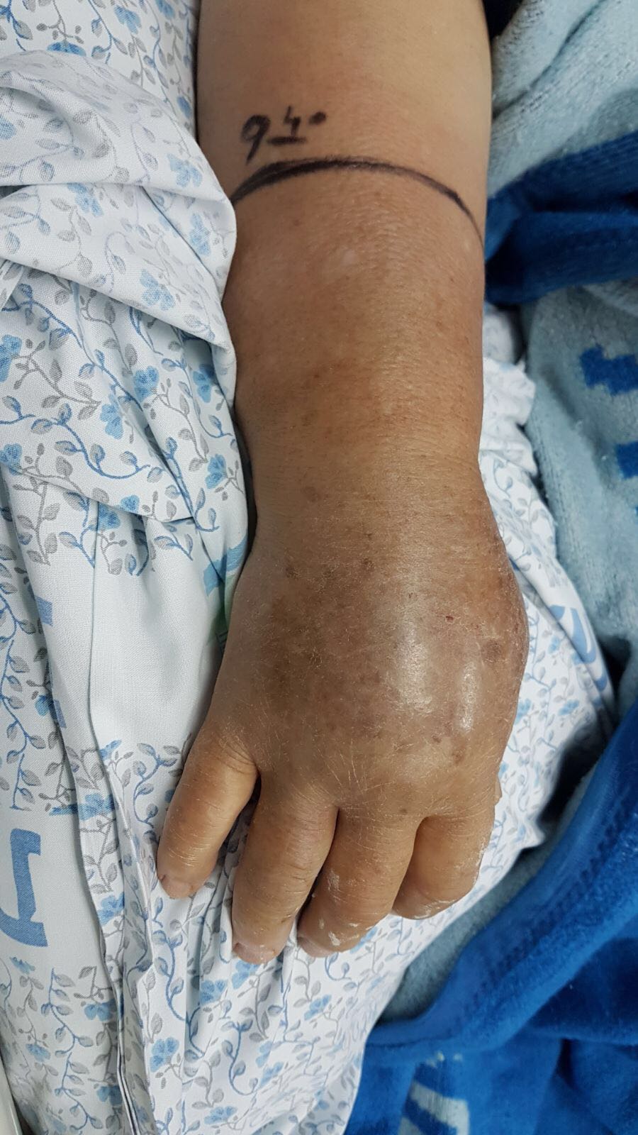 היד בה הוכשה