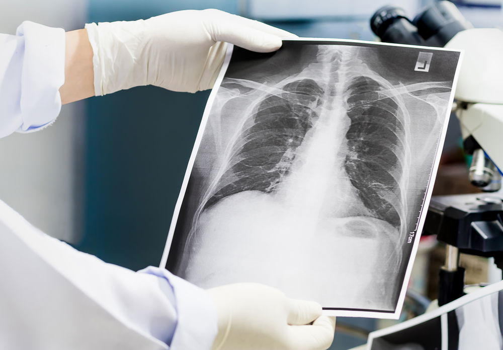 אילוסטרציה