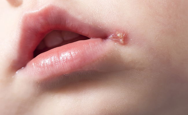 אילוסטרציה