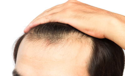 אילוסטרציה