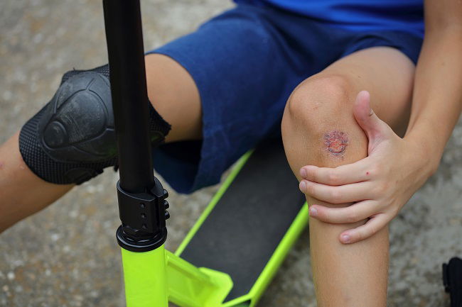 נפל מקורקינט ויקבל 200 אלף ש"ח פיצויים