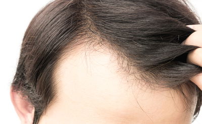 אילוסטרציה