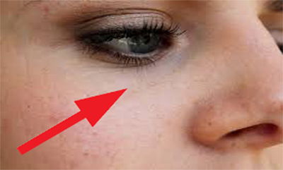 פנים חלקות וזוהרות. אילוסטרציה