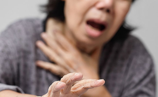 אשה שהשתעלה גרמה לעצמה שבר בצלעות