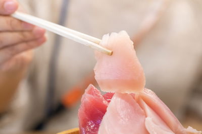 אכל סושי כל יום ומצא בגופו תולעת באורך 170 ס"מ