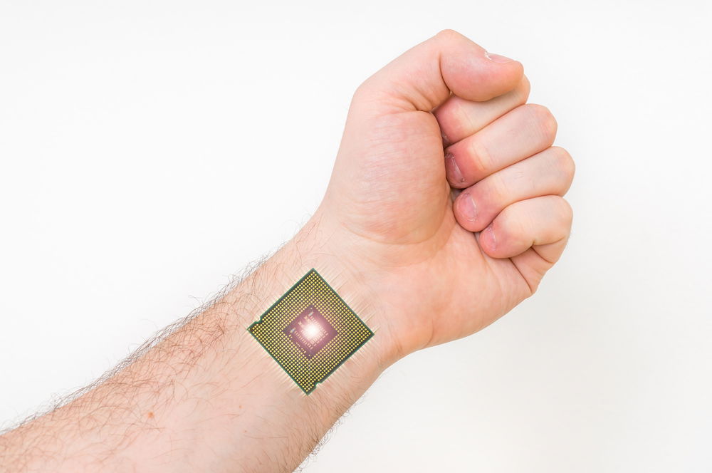 השתיל שבב של "רב-קו" בכף היד, ותובע את הרשויות