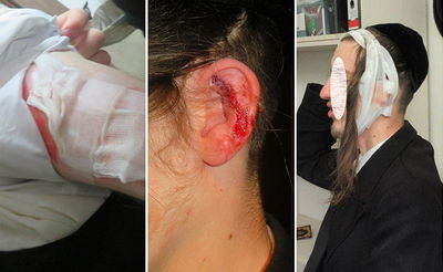 חלק מהפציעות