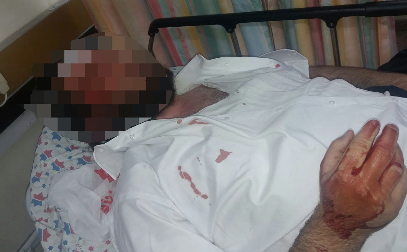 וולקן בבית החולים. התמונה טושטשה בשל חומרת הפציעות