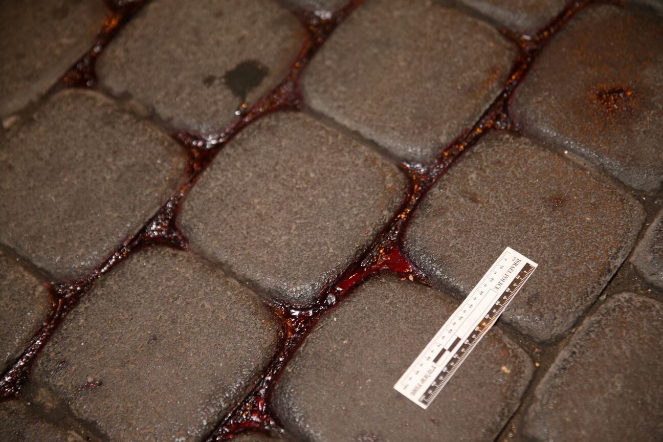 תושב מאה שערים משחזר: "זה היה מפחיד, חשבתי שמת"