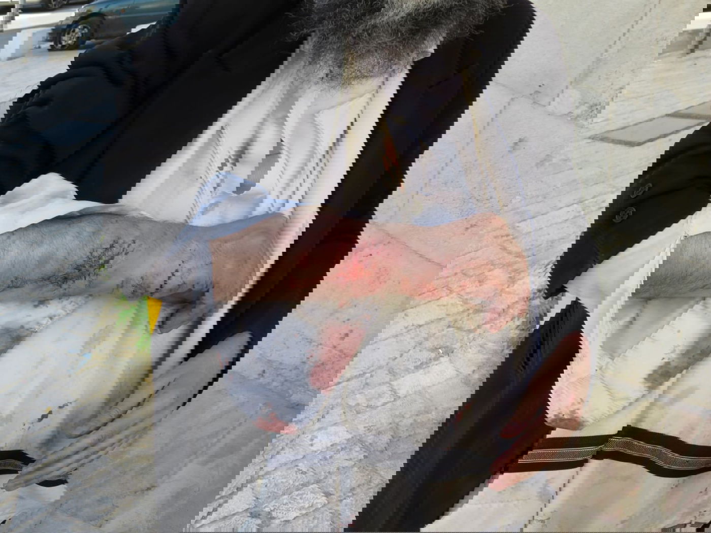 אברך הוכה בידי שוטרים; "בשביל שתספר לכל החברים החרדים המסריחים שלך"