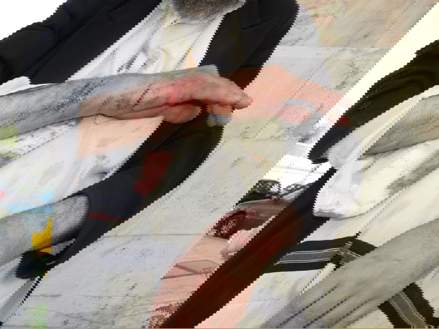 אברך הוכה בידי שוטרים; "בשביל שתספר לכל החברים החרדים המסריחים שלך"