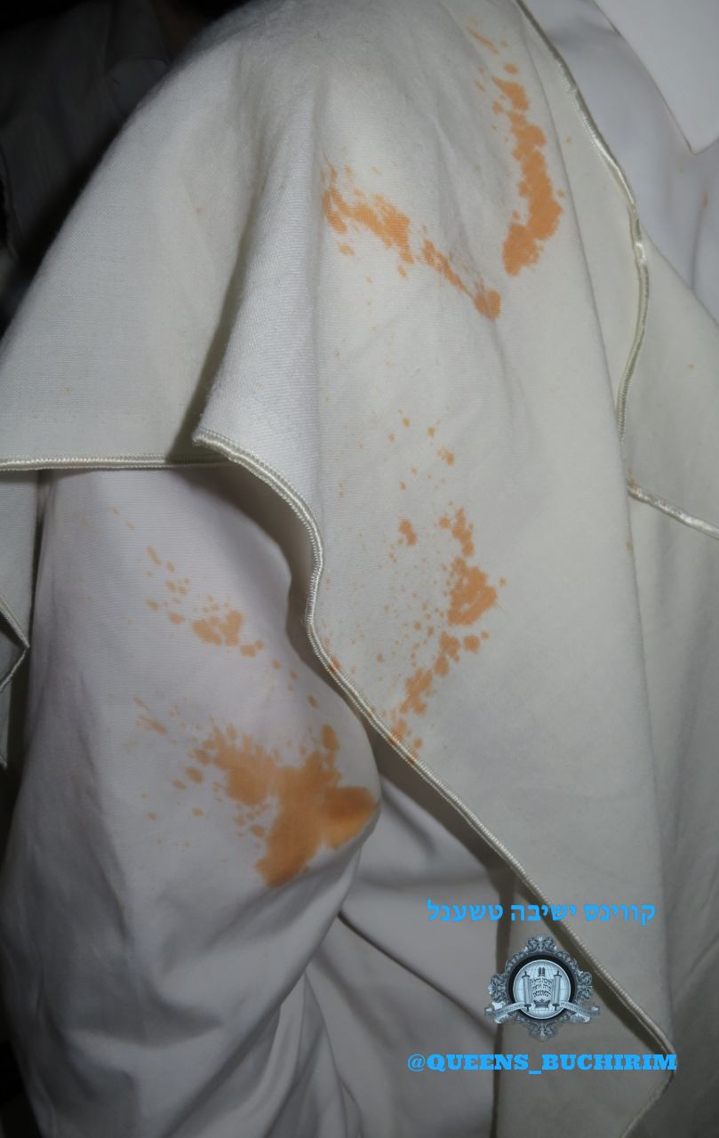 בגדיו של המשגיח שרוסס בגז מדמיע, לאחר שהותקף