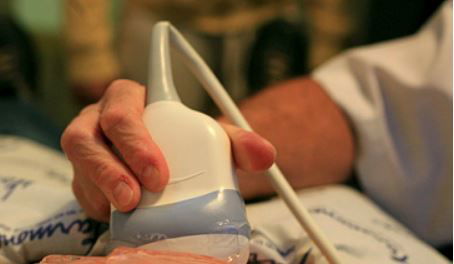 אולטראסאונד