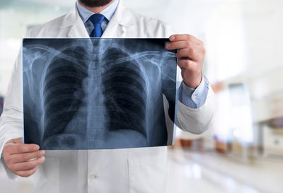 דלקת ריאות, חיסונים וכל מה שביניהם