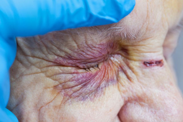 אילוסטרציה