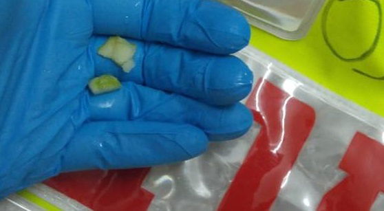 תינוק נחנק מתפוח; הובהל לבית החולים