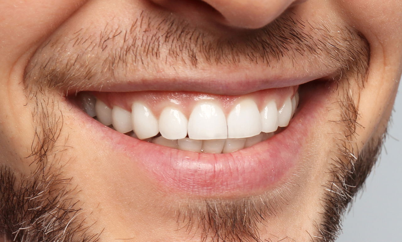 הרב התיר לאברך לחייך למצלמה - בשבת