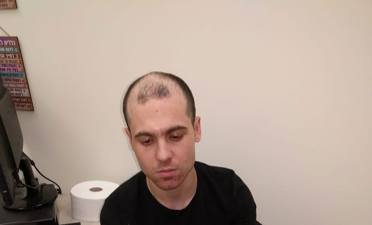 המשטרה מזהירה מפני עצור מסוכן שברח