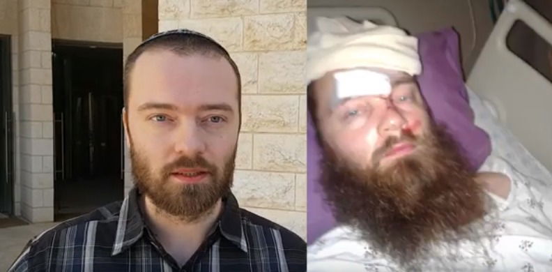 פצוע הפיגוע תובע מעל מיליון ש"ח מהמחבל