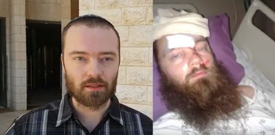 פצוע הפיגוע תובע מעל מיליון ש"ח מהמחבל