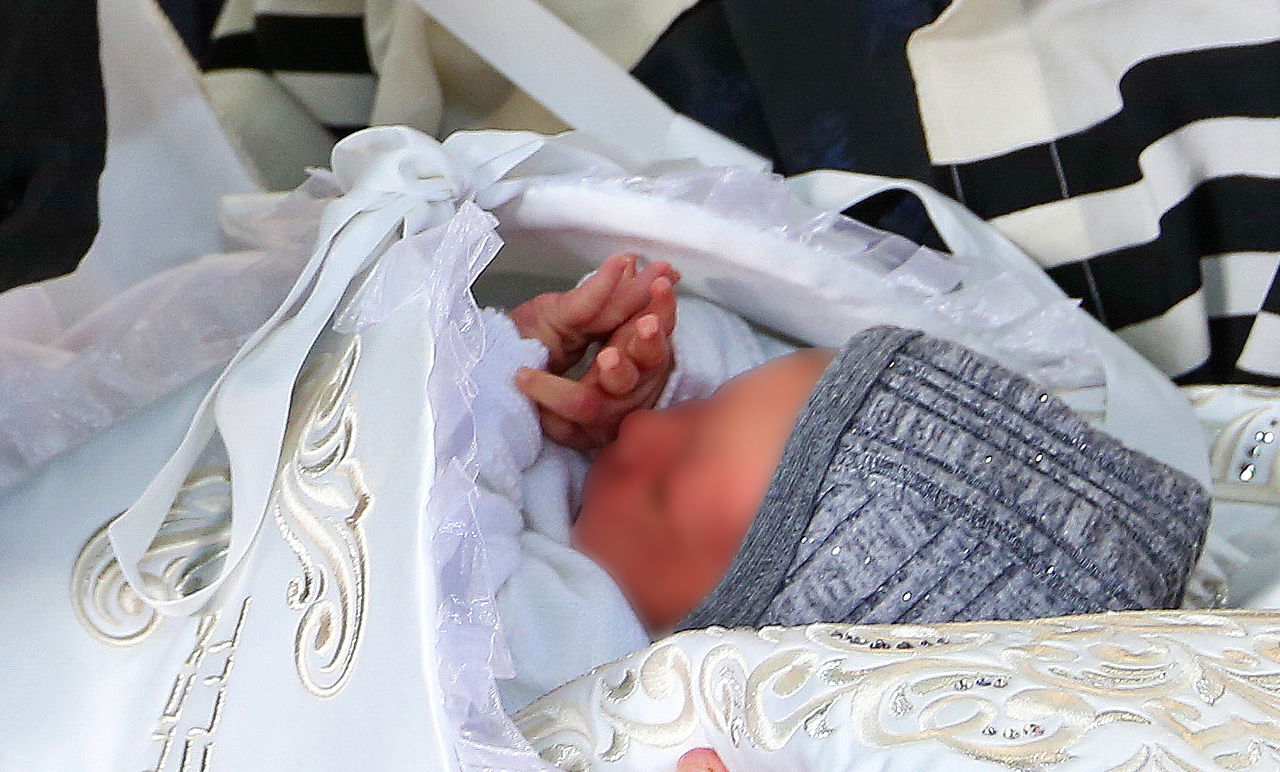 ברית מילה. אילוסטרציה