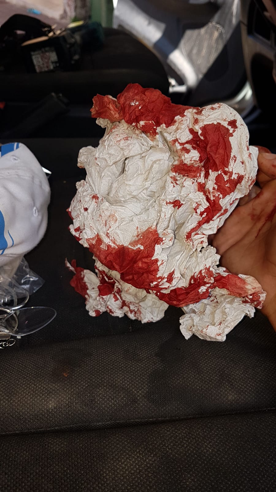 מחלץ הפעוטה שנשכחה: רצתי, לקחתי פטיש ושברתי חלון